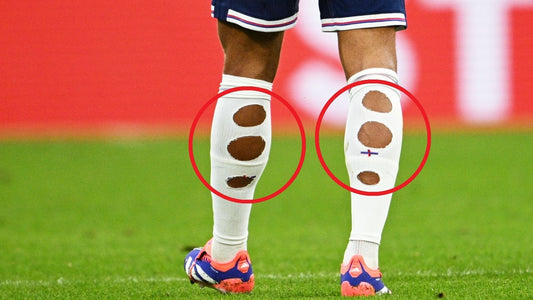 Pourquoi ces joueurs font-ils des trous dans leurs chaussettes ?